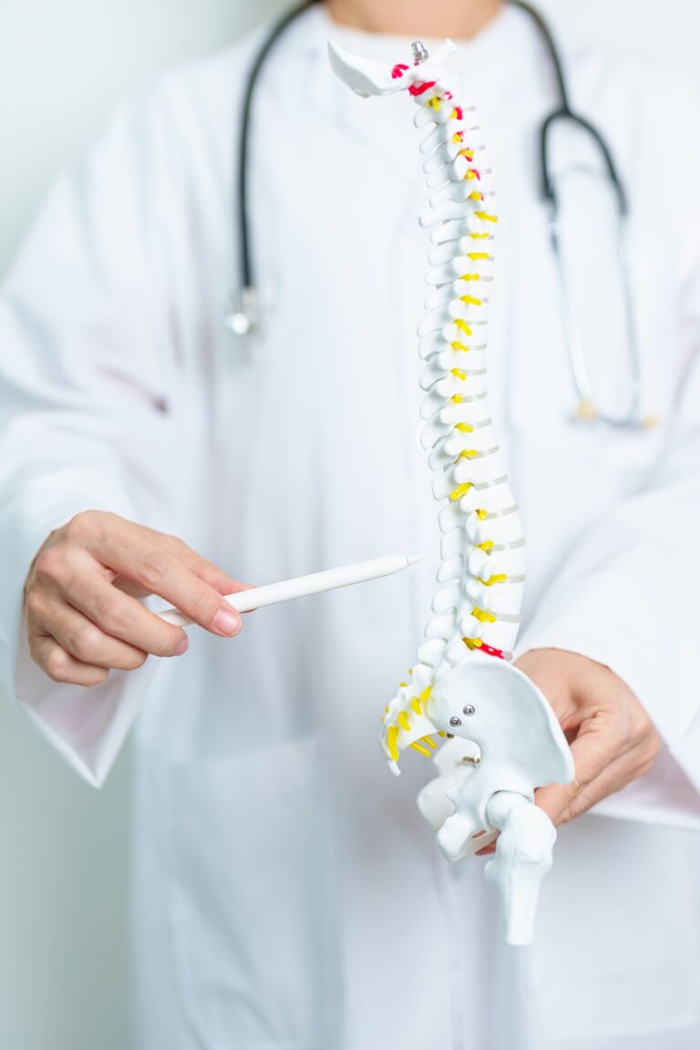 Doctor with human Spine anatomy model. Spinal Cord Disorder