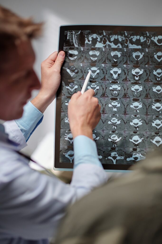 Radiologist Showing Spine Discs Xray